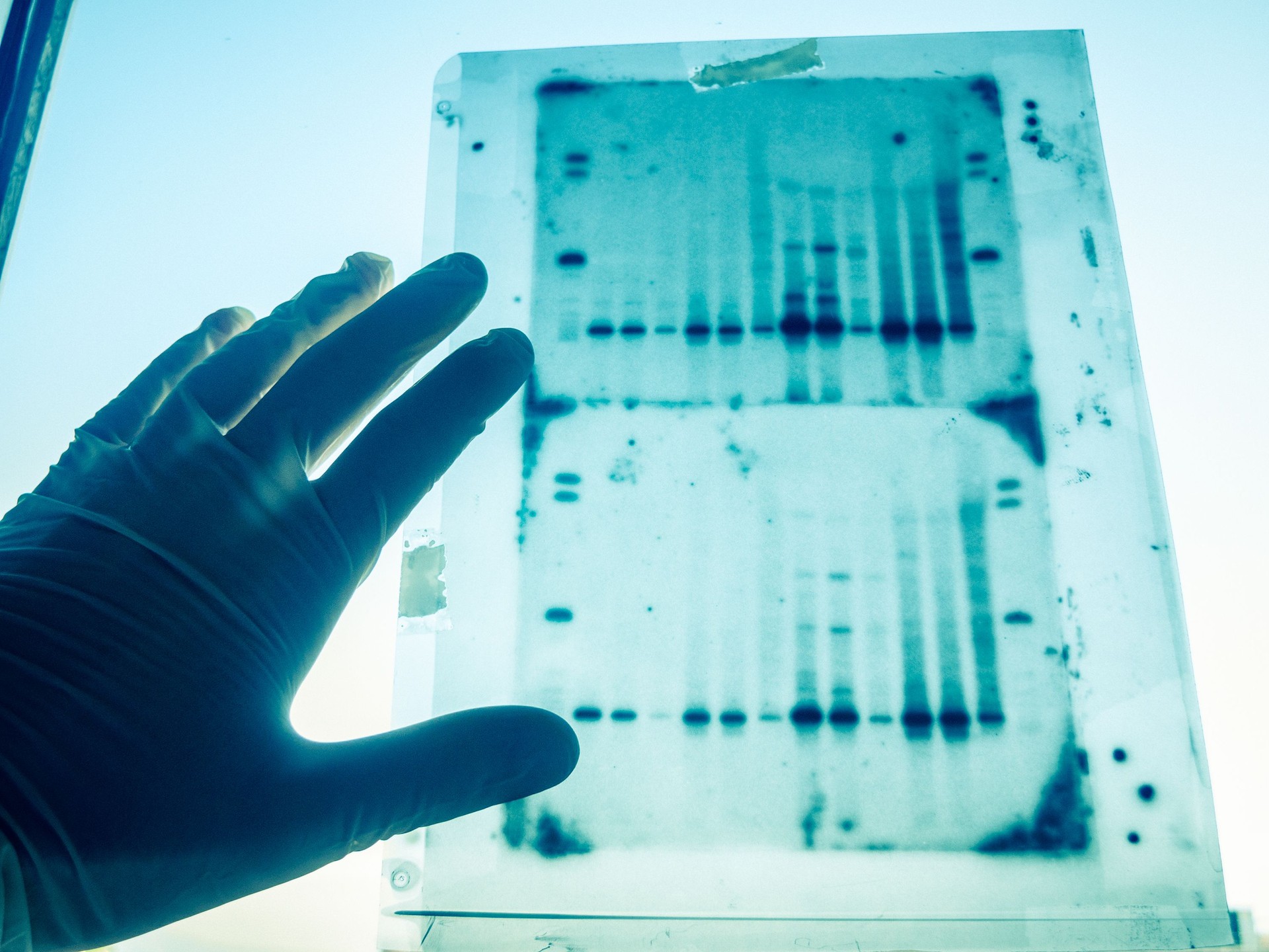 DNA genetic analysis results