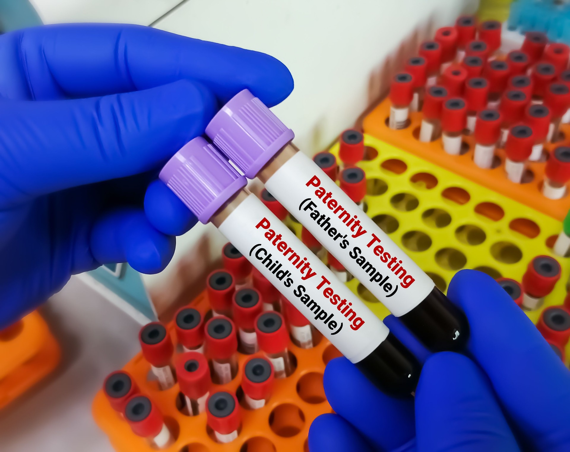 Paternity testing by DNA sequencing of Father's and children's blood sample.